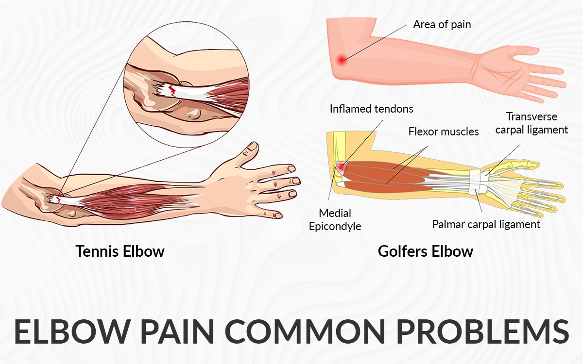 Elbow Pain Common Problems Dr Saurabh Aggarwal